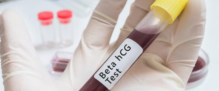 Gebelik Testi (Beta HCG)